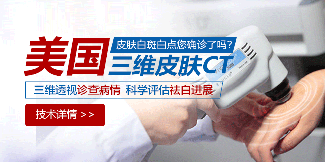 青岛金肤康白癜风医院